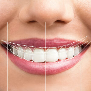 Chattanooga periodontics  dental implants