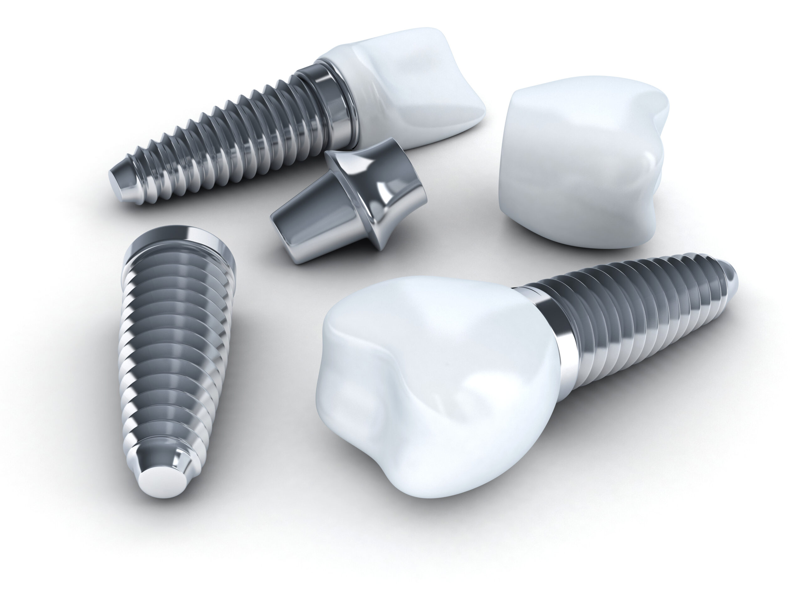 Chattanooga periodontics dental implants